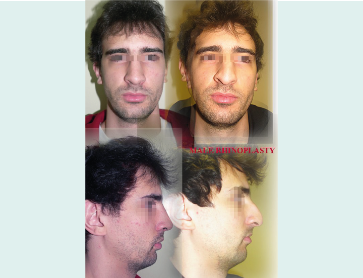 Artboard 11